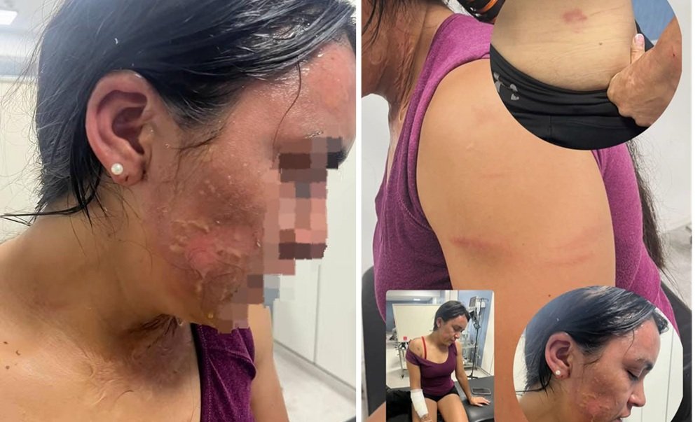 El influencer Jorgito Barrionuevo denunció que agredieron y quemaron con agua hirviendo a su hermana