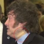 Misterio por el vendaje de Milei en el cuello: cuál es la explicación oficial