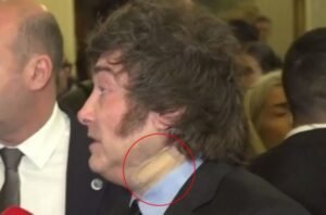 Misterio por el vendaje de Milei en el cuello: cuál es la explicación oficial